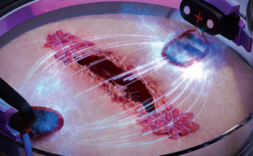 Cura De Feridas Três Vezes Mais Rápido Com Eletricidade