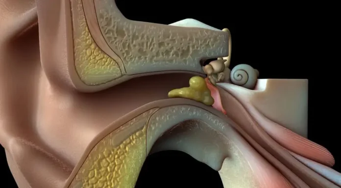 Cera de Ouvido Será Base de Exames e Diagnósticos