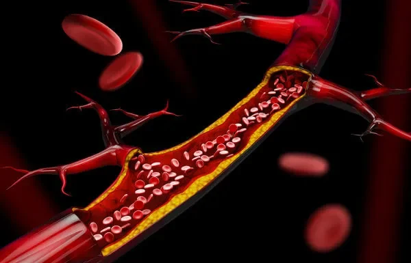 Facilitará Cirurgias: Nova Estrutura Imita Vasos Sanguíneos