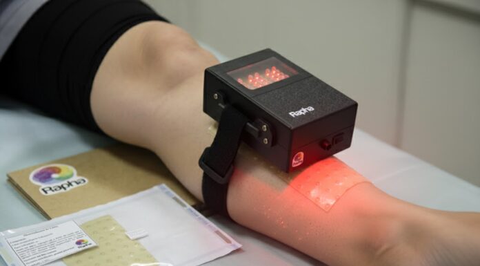 Rapha: UNB Desenvolveu Dispositivo que Acelera Cura de Pé Diabético