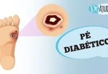 Por que Ocorre e Como Prevenir o Pé Diabético? | Nature & Space