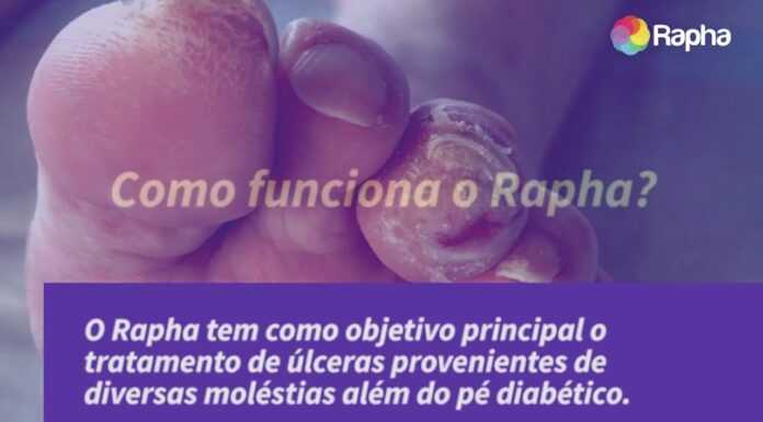 Projeto Rapha: Dispositivo Criado na UnB Acelera Cicatrização de Feridas
