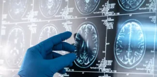 Pesquisa da UFRGS Sugere que Alzheimer Teria Causa em Inflamação no Cérebro