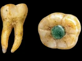 Odontologia Maia: Descoberta Inédita Mostra Que Maias Inseriam Pedras Para Tratar Dente | Nature & Space
