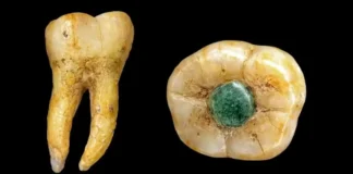 Odontologia Maia: Descoberta Inédita Mostra Que Maias Inseriam Pedras Para Tratar Dente | Nature & Space