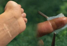 IA Em Adesivo Curativo Na Pele Coleta Dados de Saúde, Analisa e Age Sobre o Corpo em Milissegundos | Nature & Space