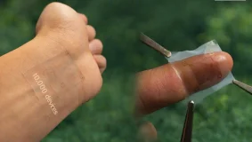 IA Em Adesivo Curativo Na Pele Coleta Dados de Saúde, Analisa e Age Sobre o Corpo em Milissegundos | Nature & Space